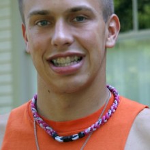 Teens braces invisible