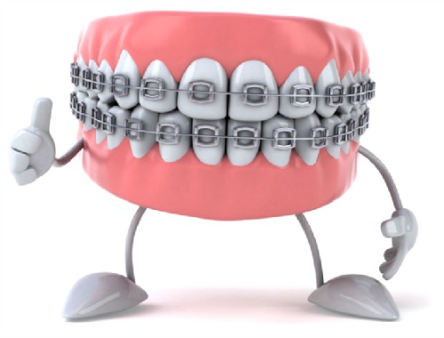 Dental Braces: Treatment Options a Retrospect